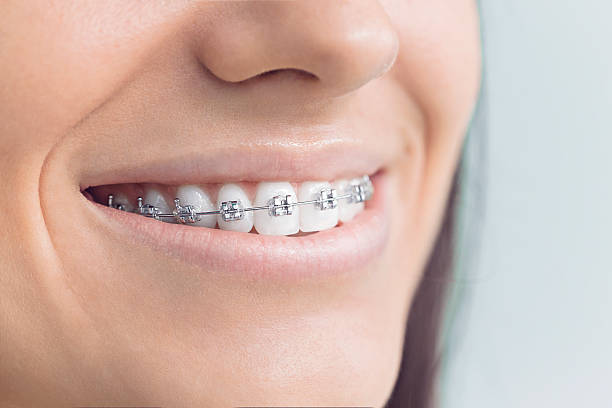 Best Dental Inlays and Onlays  in Delhi Hills, OH